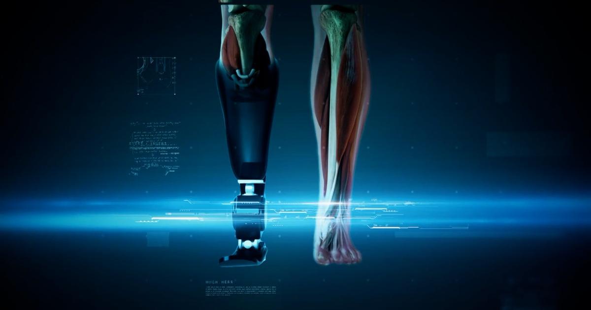 Building a Better Prosthetic Leg for Amputees - News Center