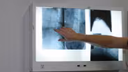Inside Gynecological Cancers - Preview