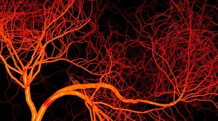Video thumbnail: Health Matters: Television for Life Heart and Stroke