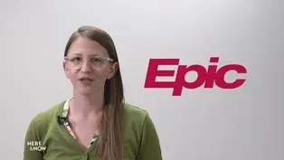 Fast Facts: Epic Systems v. Lewis