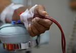 Severe kidney damage in some COVID-19 cases alarms doctors