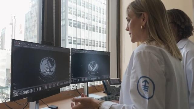 What to know about colon cancer cases among young adults