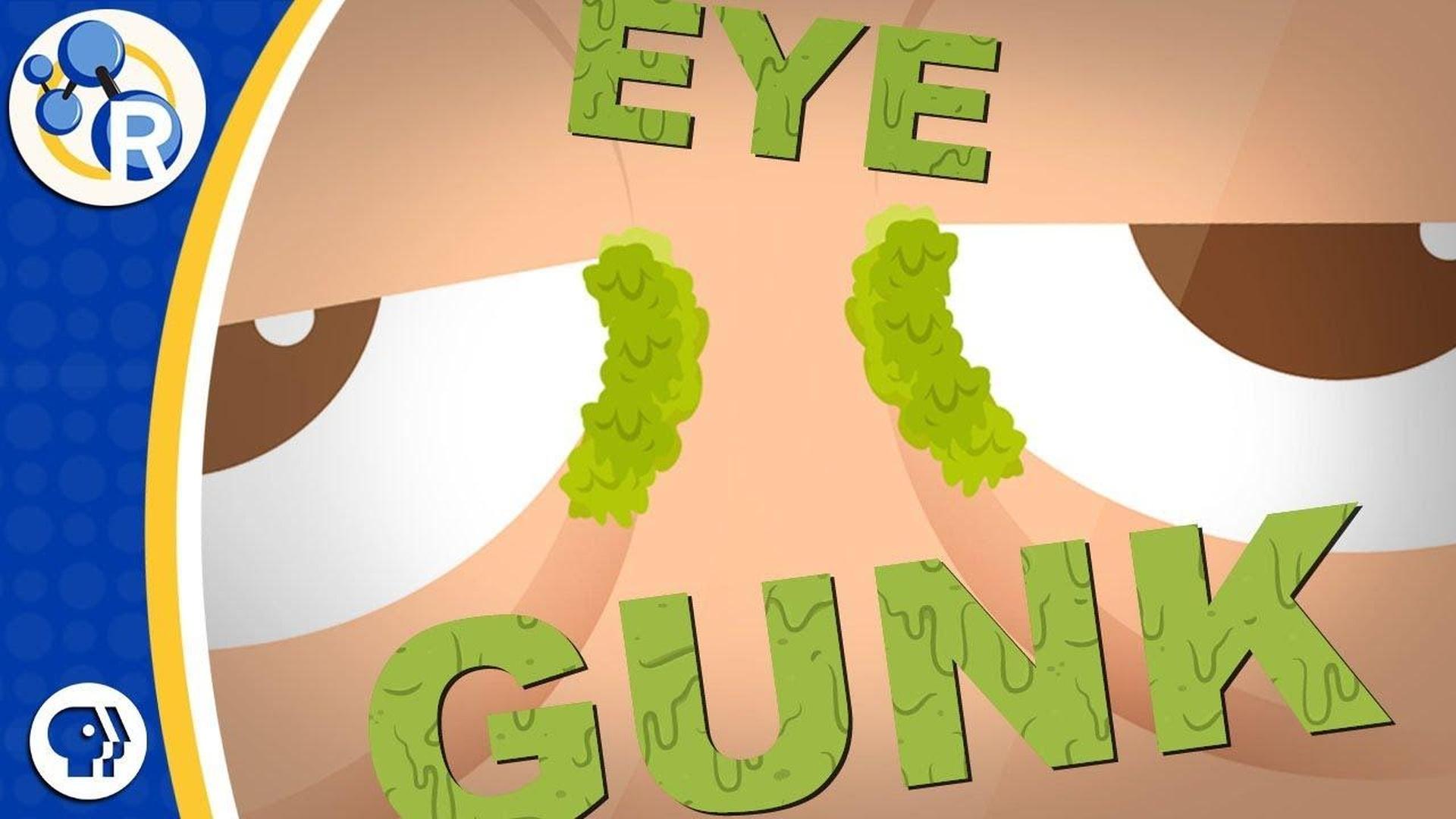 What are Eye Boogers? Reactions ALL ARTS