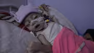 Rising food insecurity is killing war-torn Yemen's children