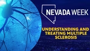 Understanding and Treating Multiple Sclerosis