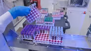 How trove of genetic data can yield individualized medicine