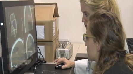 Video thumbnail: SciTech Now Brain Surgery Utilizes 3D Imaging