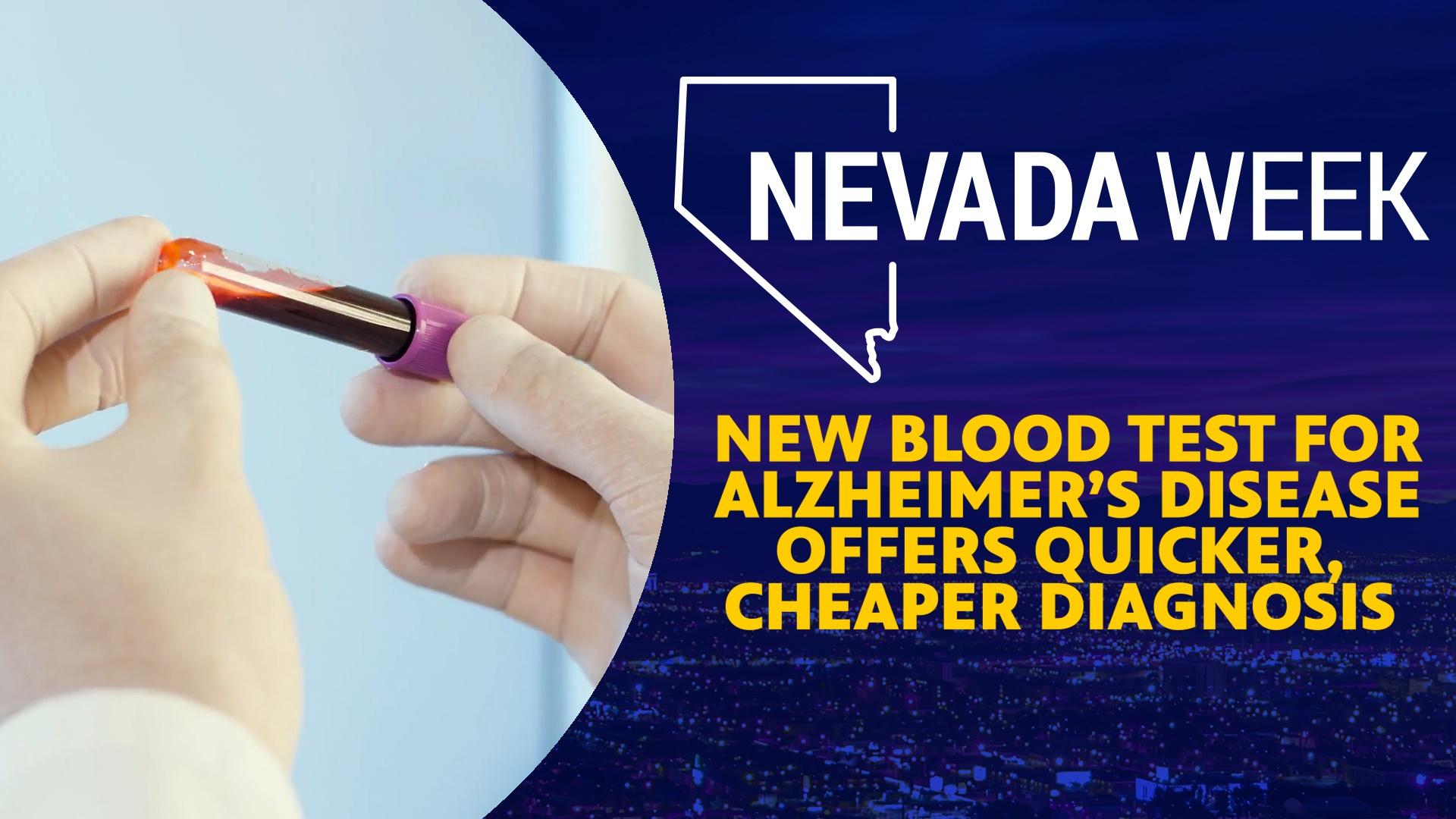 New Blood Test for Alzheimer’s Disease Offers Quicker, Cheaper Diagnosis