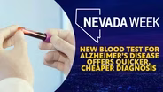 New Blood Test for Alzheimer’s Disease Offers Quicker, Cheaper Diagnosis