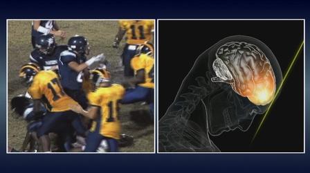 Video thumbnail: KQED NEWSROOM Concussions in Youth Sports, SF Criminal Justice Fees