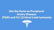 Facts on Peripheral Artery Disease & Critical Limb Ischemia