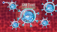 CAR T-cell Therapy | Focus on Health