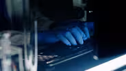 How Algorithms Decide Who Gets a Kidney