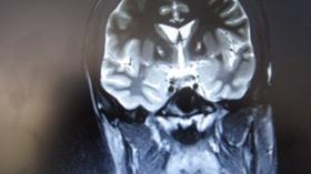 Video thumbnail: Your Fantastic Mind Your Fantastic Mind: Episode 9