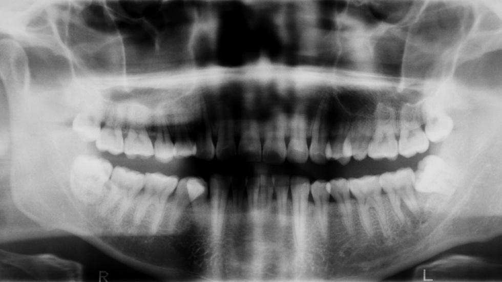 Library Enhancements; Dental Disparities image