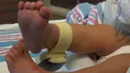 Lawsuit seeks to end NJ's storage of baby bloodspots