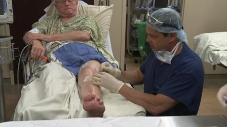 Video thumbnail: NJTV News Clinical trial tests the healing power of stem cells