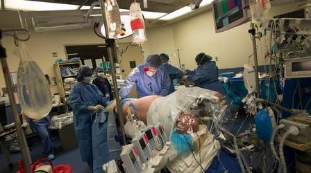 Video thumbnail: PBS NewsHour Government announces organ transplant system overhaul plan