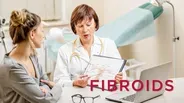 Fibroids