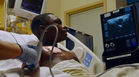 Video thumbnail: NOVA Living with Sickle Cell Anemia