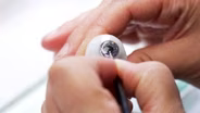 Eye prosthetics become canvases for self-expression