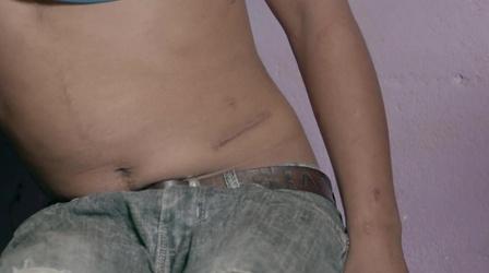 Video thumbnail: PBS NewsHour Trafficking victims forced to sell organs share stories