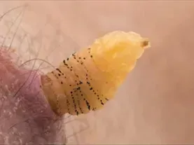 Researcher Raises Botflies Under Skin