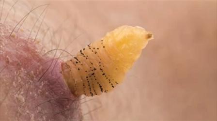 Video thumbnail: NOVA Researcher Raises Botflies Under Skin