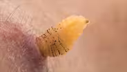 Researcher Raises Botflies Under Skin