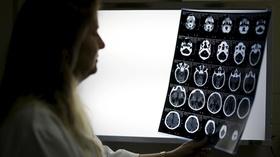 Video thumbnail: PBS NewsHour Racial bias in widely used hospital algorithm, study finds