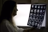 Racial bias in widely used hospital algorithm, study finds