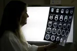 Racial bias in widely used hospital algorithm, study finds