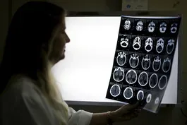 Racial bias in widely used hospital algorithm, study finds