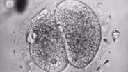 Chapter 1 | Test Tube Babies