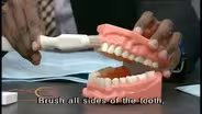 Cleaning Teeth