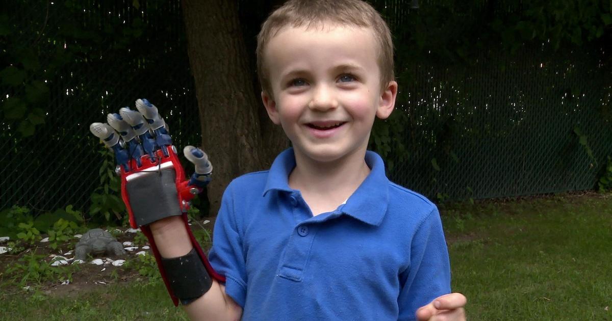 Design Squad 3D Printed Hands PBS