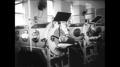 Polio and Iron Lungs in the 1950s. Le Clercq's Illness. 