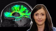 4 Odd Things We've Seen in Your Brain