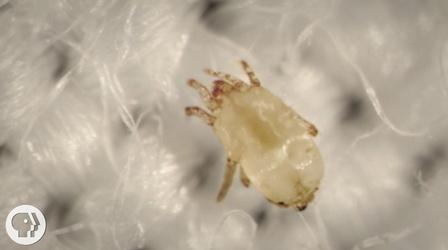 Video thumbnail: Deep Look Meet the Dust Mites, Tiny Roommates That Feast On Your Skin