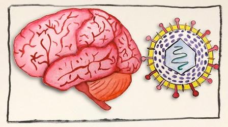 Video thumbnail: Gross Science What Can Herpes Do To Your Brain?