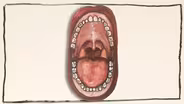 What are Tonsil Stones?
