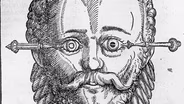 The Horrors of Ancient Cataract Surgeries