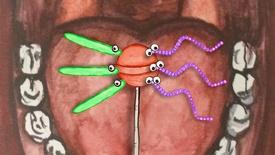 What Really Causes Cavities?: asset-mezzanine-16x9