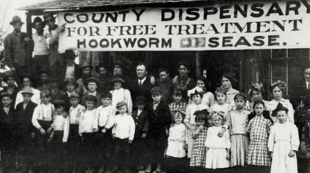Video thumbnail: Gross Science Hookworms and the Myth of the "Lazy Southerner"