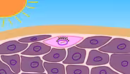 What Really Causes Sunburns?