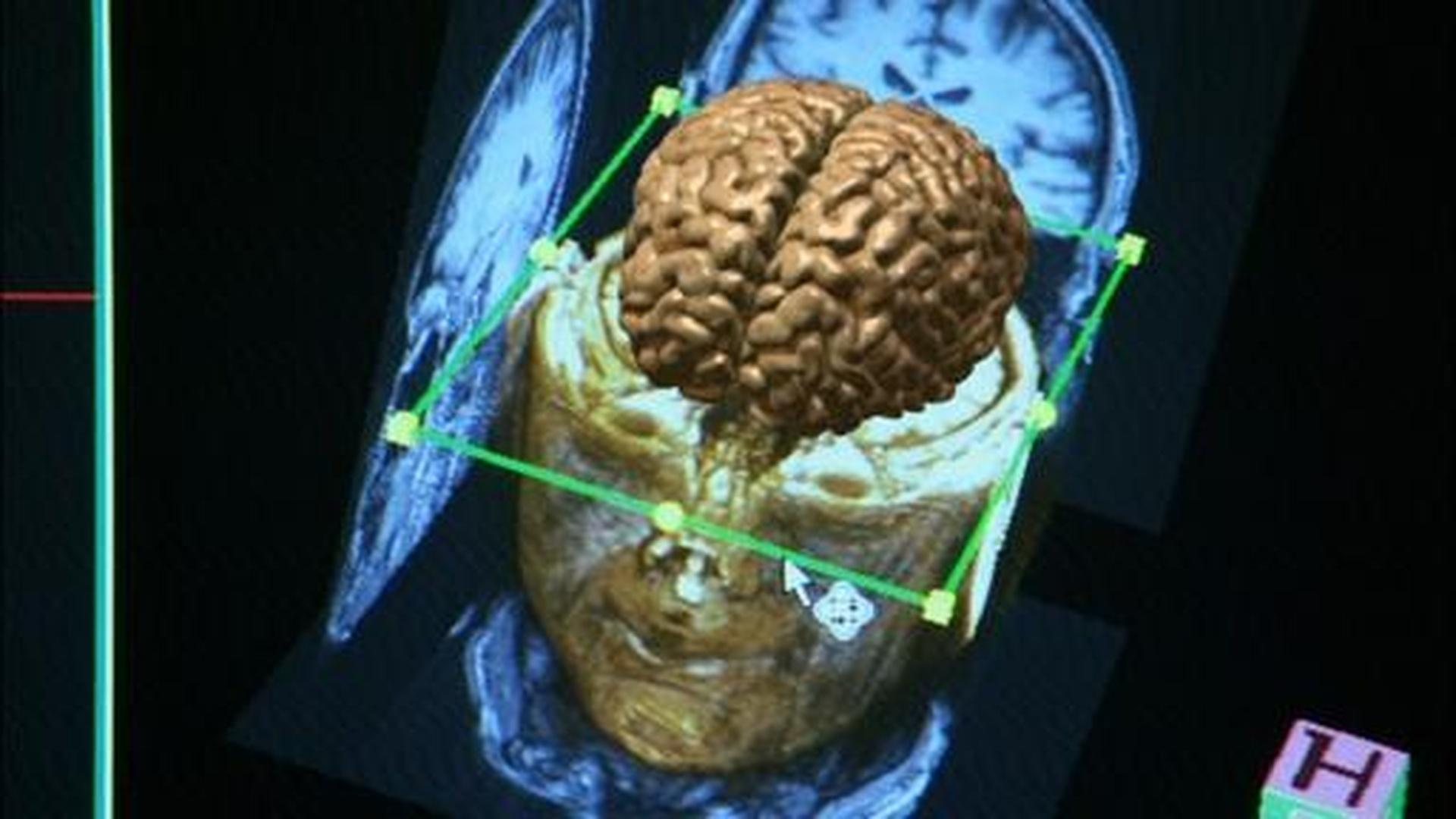 Scanning the Brain The Human Spark Video THIRTEEN New York