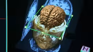Scanning the Brain