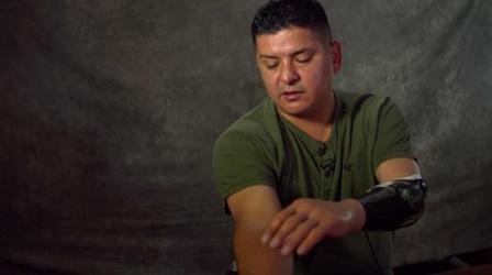 Video thumbnail: Military Medicine Ramon Padilla and Cutting-Edge Prosthetics