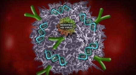Video thumbnail: PBS NewsHour Experimental therapy trains immune cells to kill leukemia