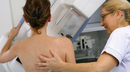 Video thumbnail: PBS NewsHour How to make sense of the new mammogram guidelines